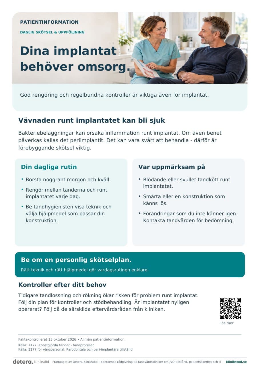Förhandsvisning av Dina implantat behöver omsorg